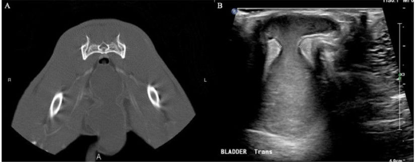 Rare Bladder Hernia in Rabbits? New Case Series Reveals Emerging Diagnosis
