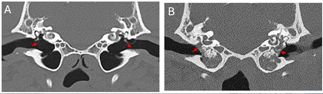 Dog Ear Sign Radiograph AI Spots Ear Disease in Dogs: Deep Learning Model Reaches 85% Accuracy ...