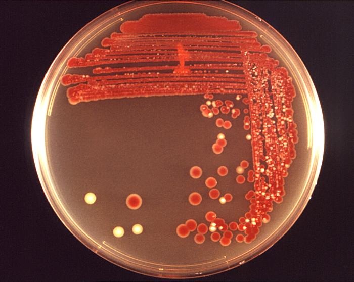 Serratia marcescens bacteria growing on a blood agar plate in a Petri dish