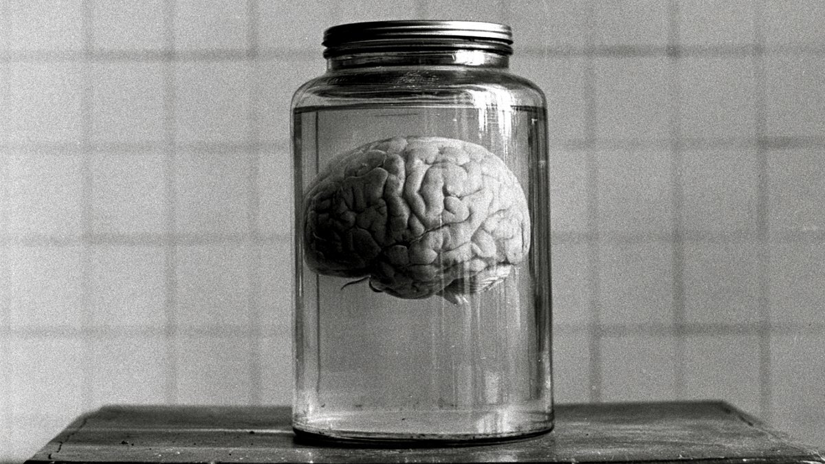 Preserved brain in a glass jar