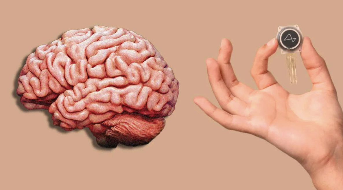 Imagina poder controlar tudo por telepatia