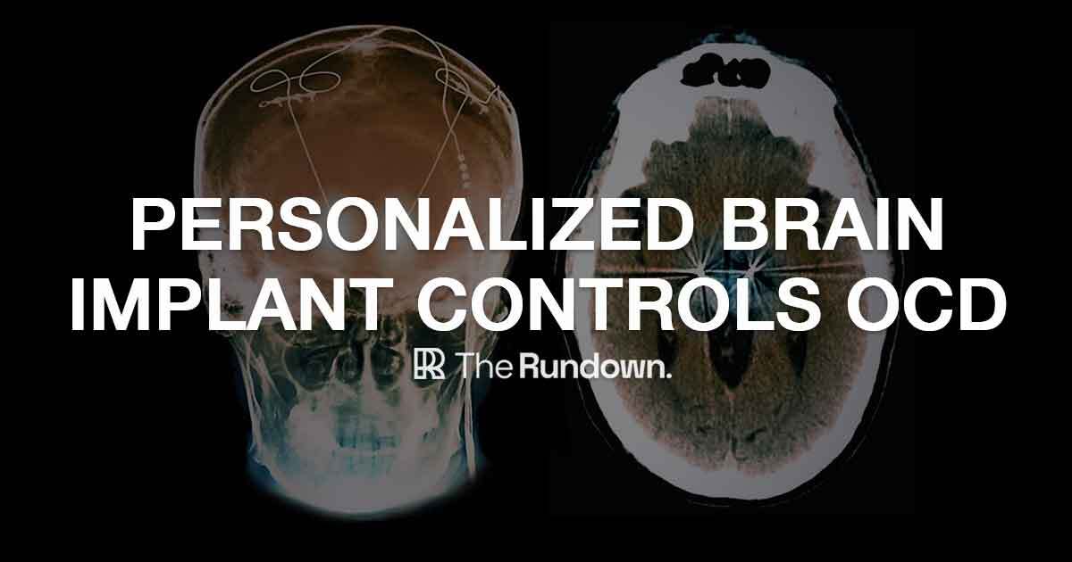 ⚡️ New brain implant breakthrough controls OCD