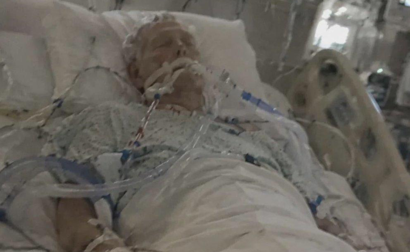 Mitch McConnell hooked up to tubes that don't connect to anything, courtesy of a computer that also forgot how skin works