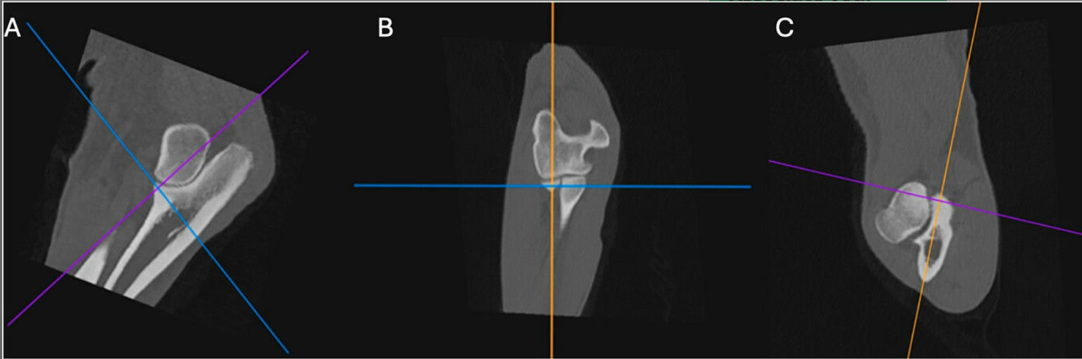 Normal Elbow Ct Scan CT Study Defines Normal Elbow Structure in Labrador Retrievers—Key ...