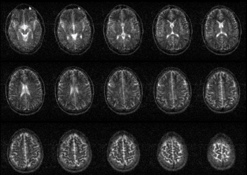 Open-Source Working MRI Scanner