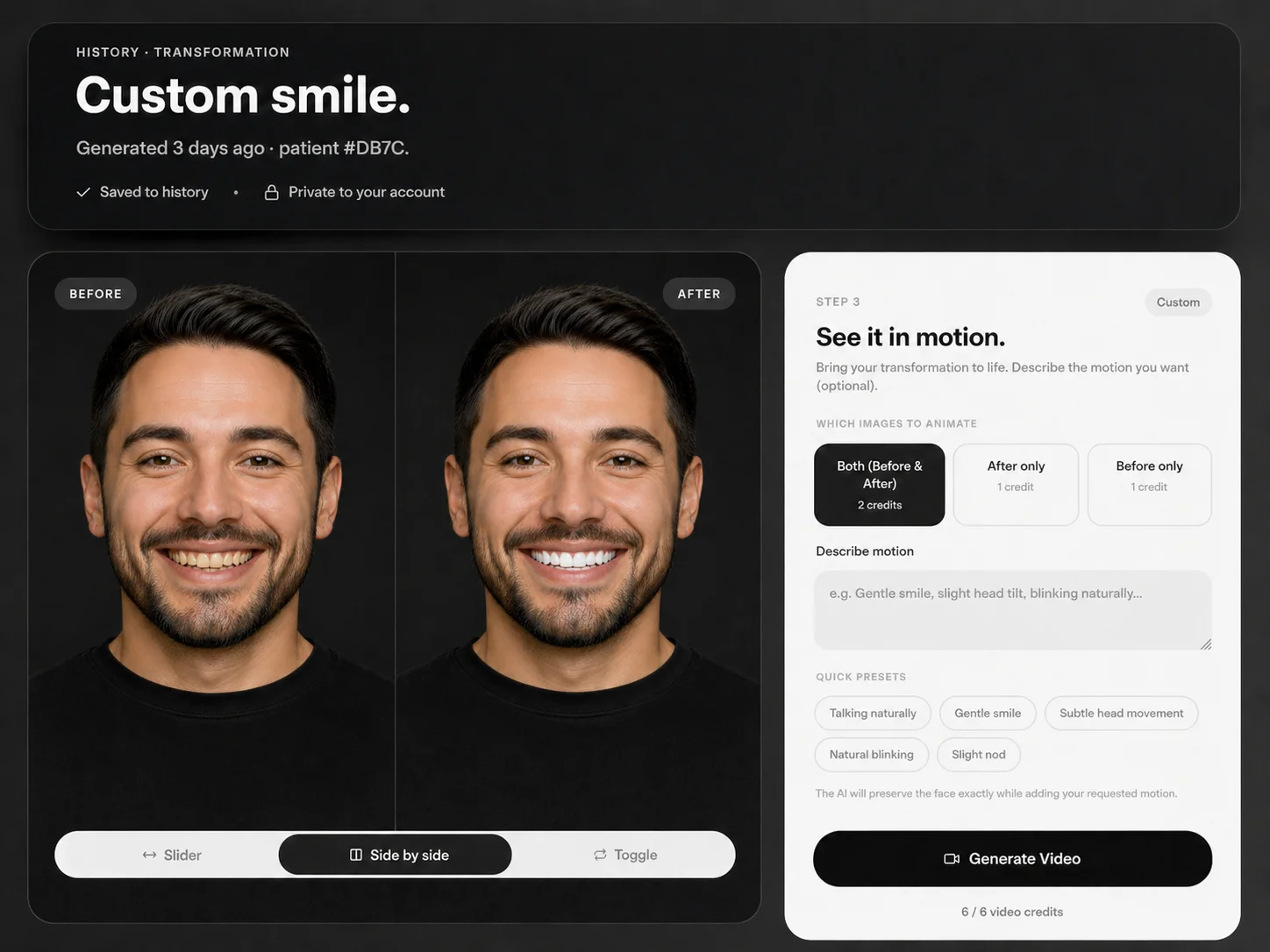 DentAI Smile AI Generator interface with before and after smile transformation