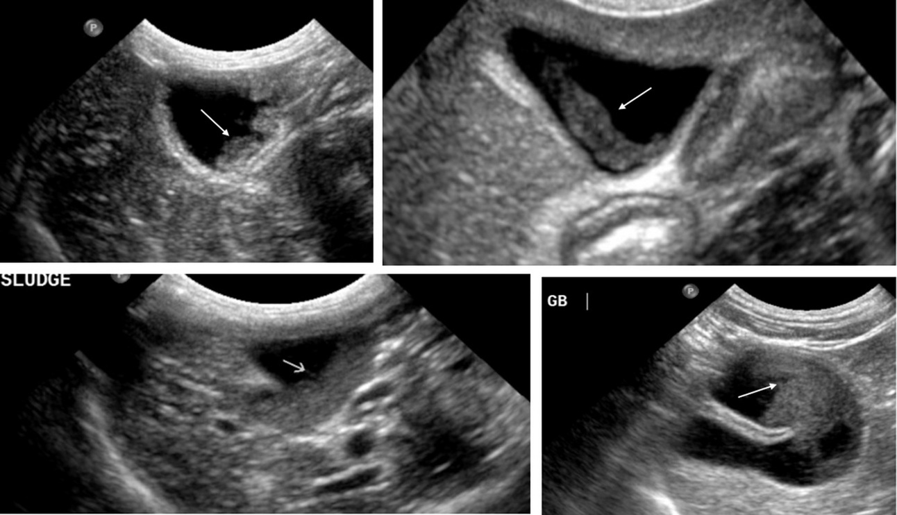 Gallbladder Sludge in Cats Prevalence and Clinical Significance