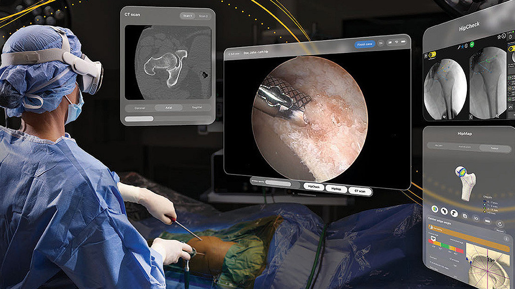Apple Vision Pro scrubs into surgery