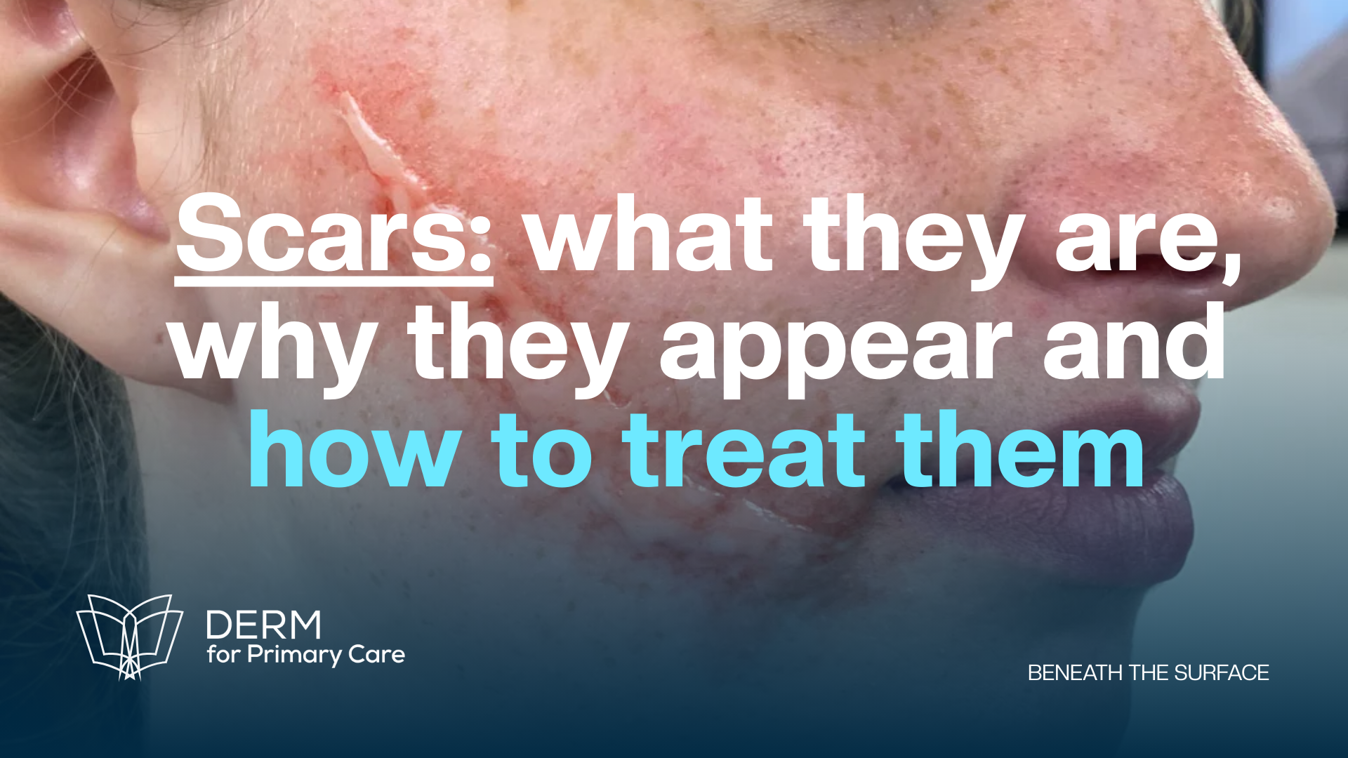 Scars Decoded: The Science Behind Healing & Transformation 🩹