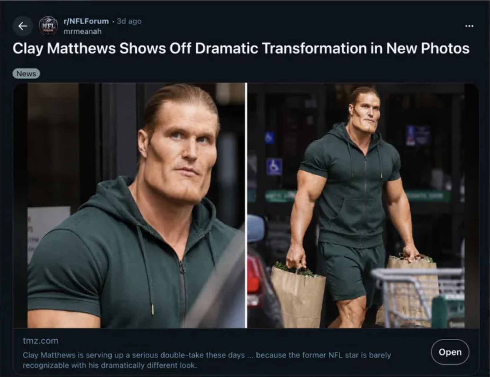 A former NFL linebacker with a dramatically altered jaw and physique, shared by a celebrity news outlet as a real transformation photo