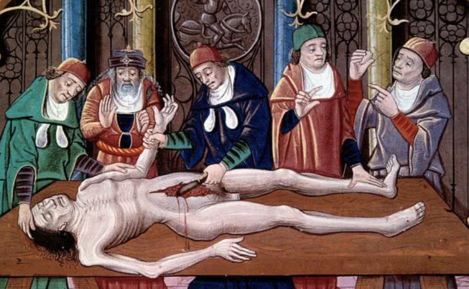 4 tratamentos absurdos que a Medicina Antiga considerava eficazes
