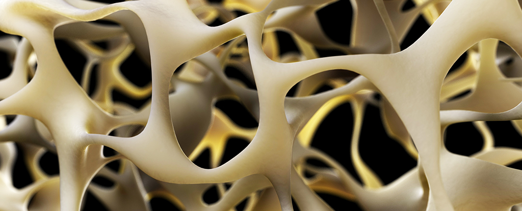 New Breakthrough Could Reverse Osteoporosis