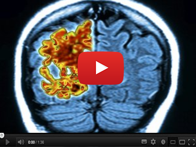 Video: What's damaging your memory and how to stop it