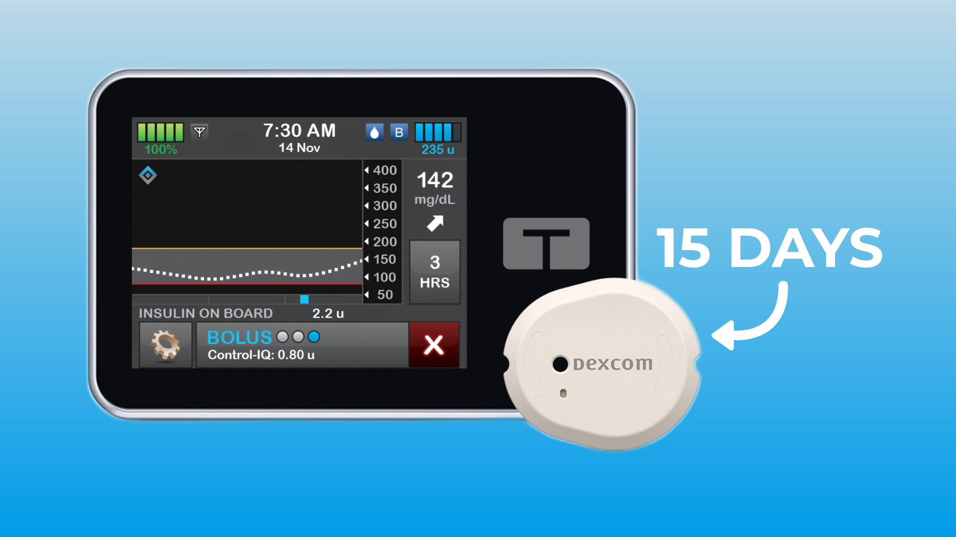 TIEMCO ティムコ EUFLEX GS693 Tandem t:slim X2 Now Compatible with Dexcom G7 15 Day CGM