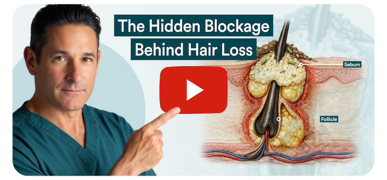 Video: The hidden blockage behind hair loss