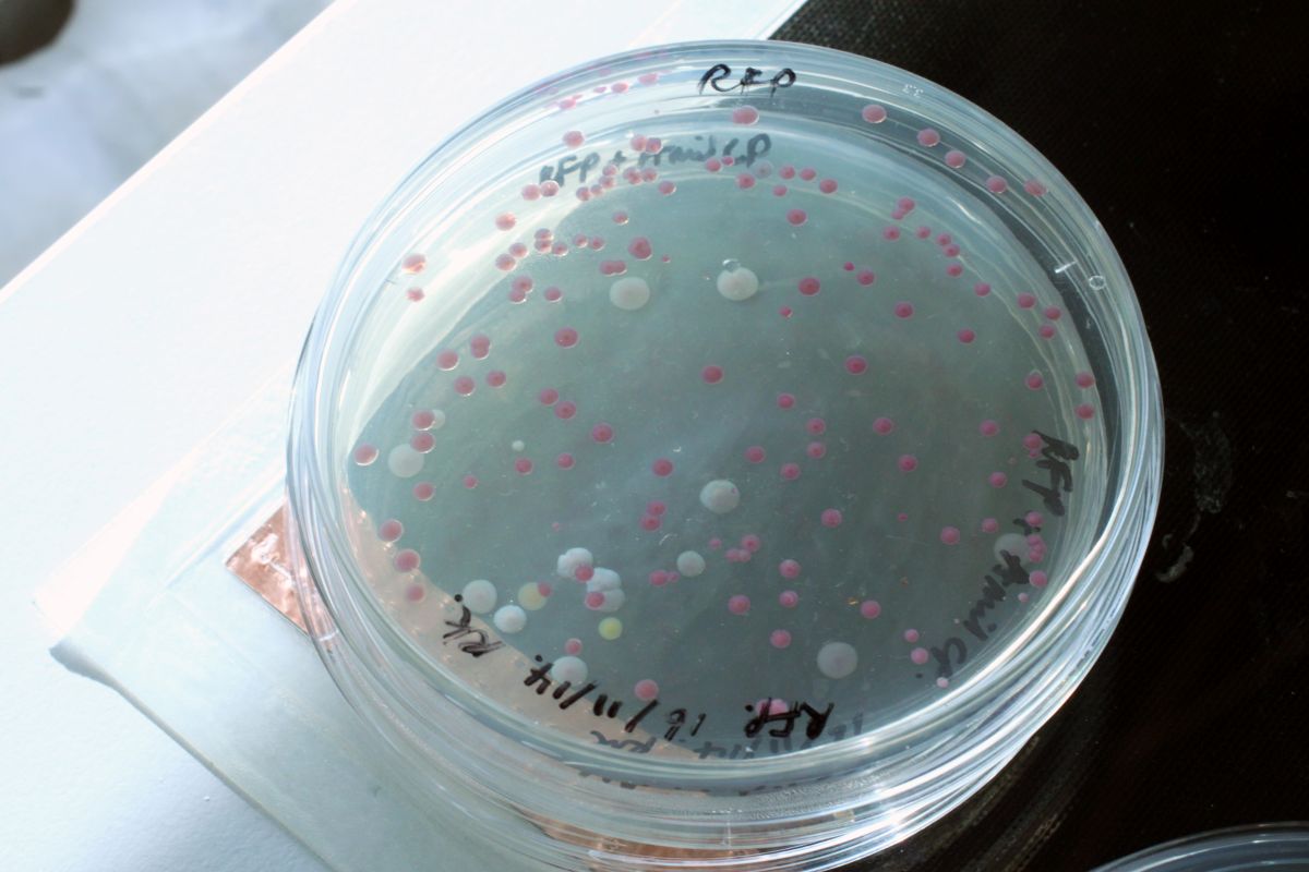 Pink bacterial colonies on a plate, with a few pale ones among them.